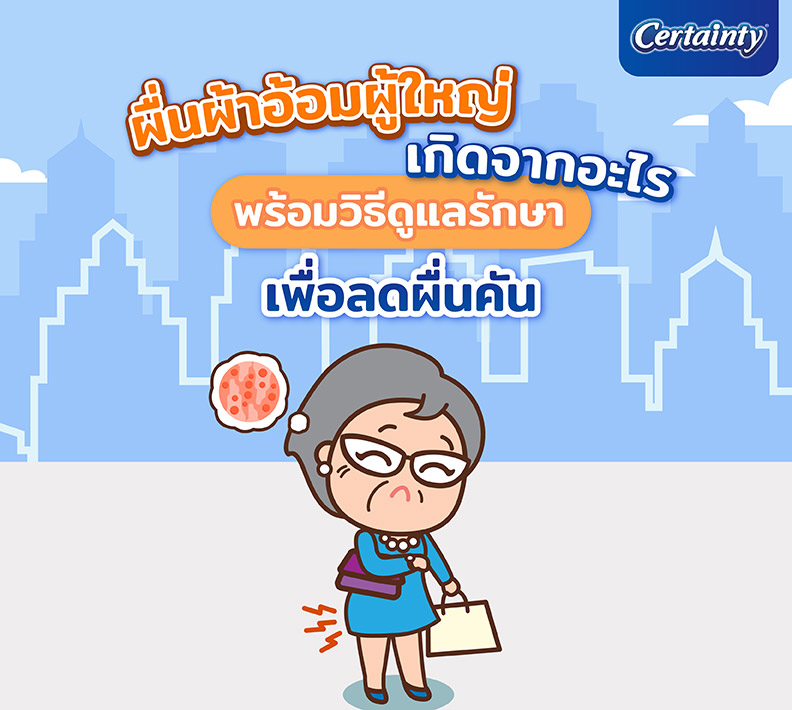ผื่นผ้าอ้อมผู้ใหญ่เกิดจากอะไร พร้อมวิธีดูแลรักษาเพื่อลดผื่นคัน
